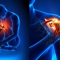 Pain Management Pain Management